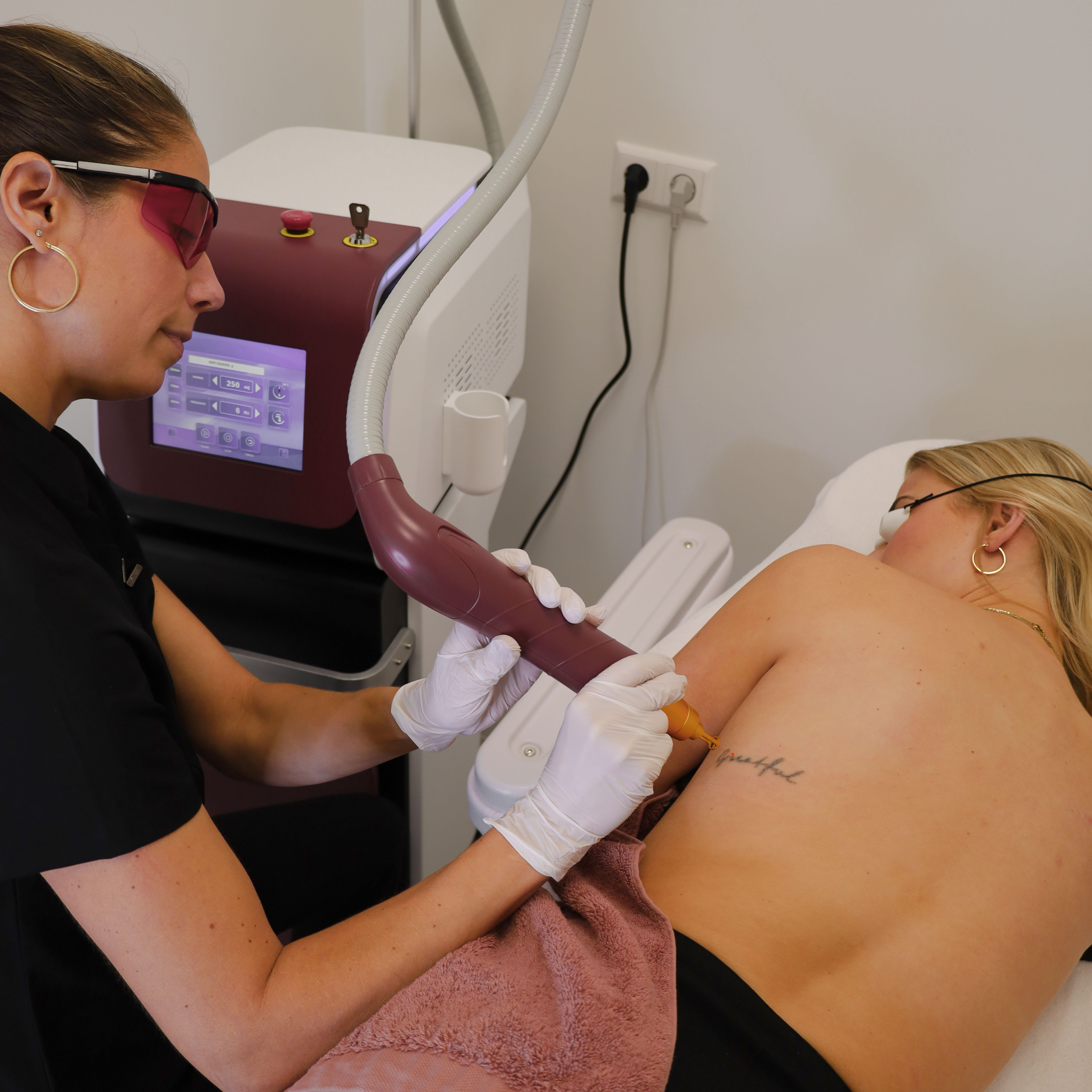 Laser behandeling